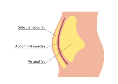 Radiofrequency and Ultrasound Body Contouring