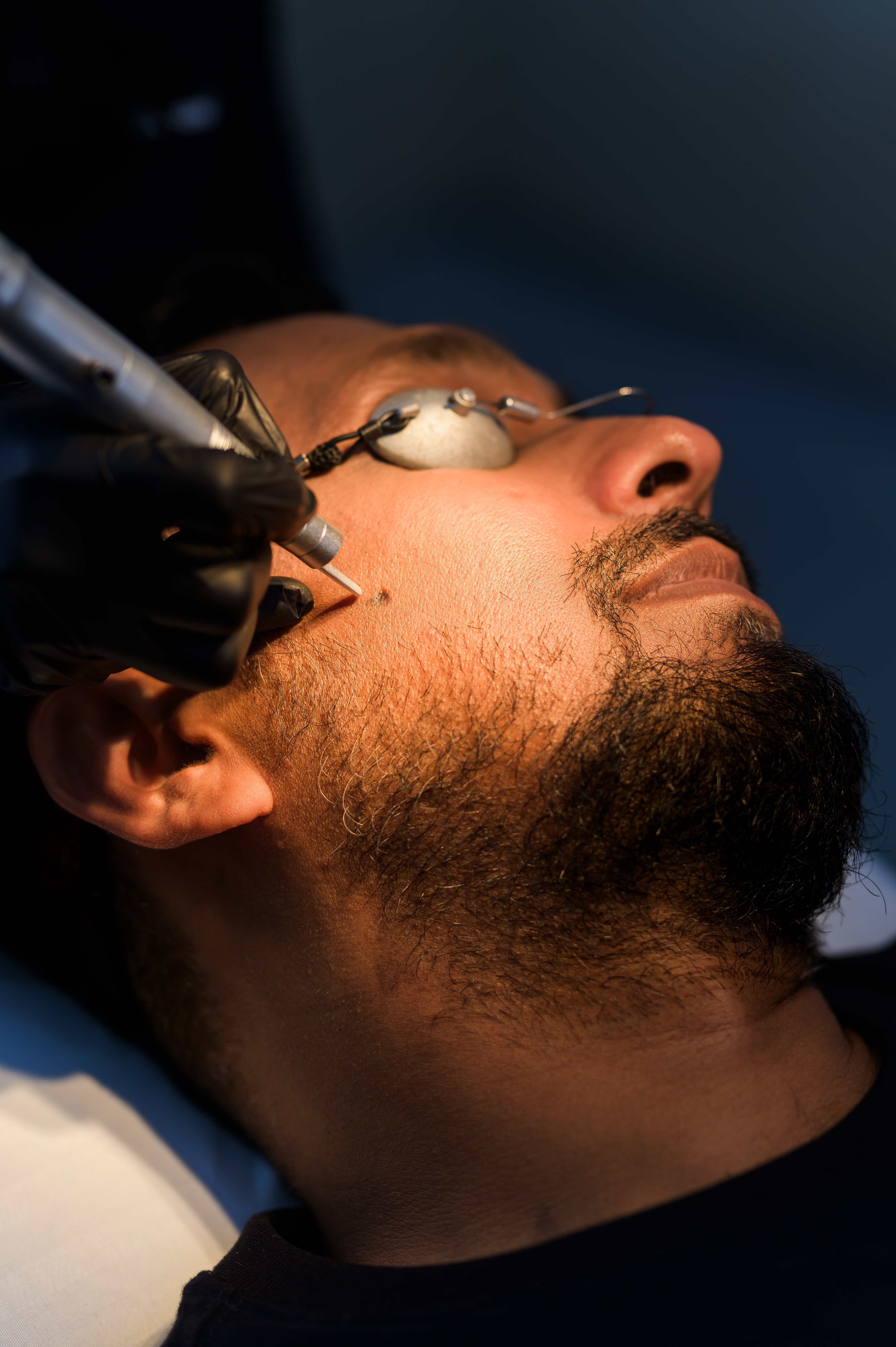 CO2 Laser Indications