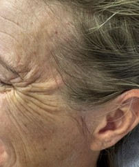 Visible signs of skin aging