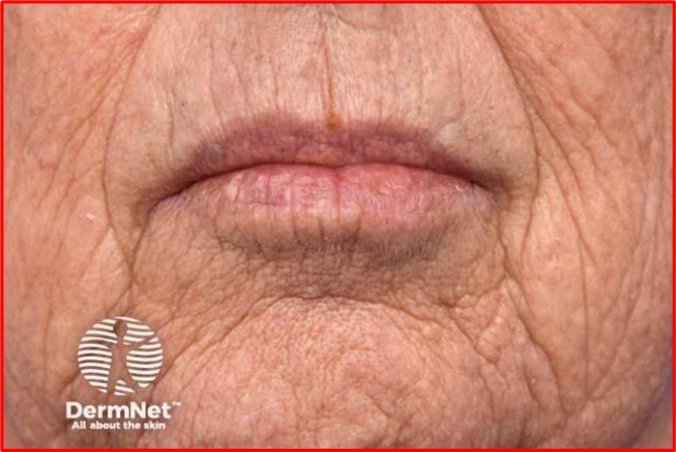 Common skin aging changes and signs