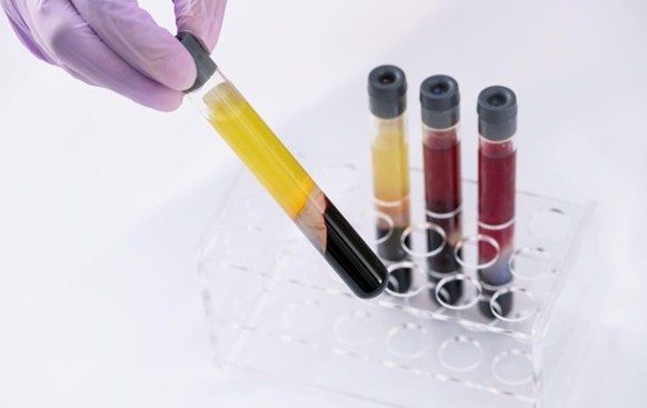 Hair Restoration Treatments