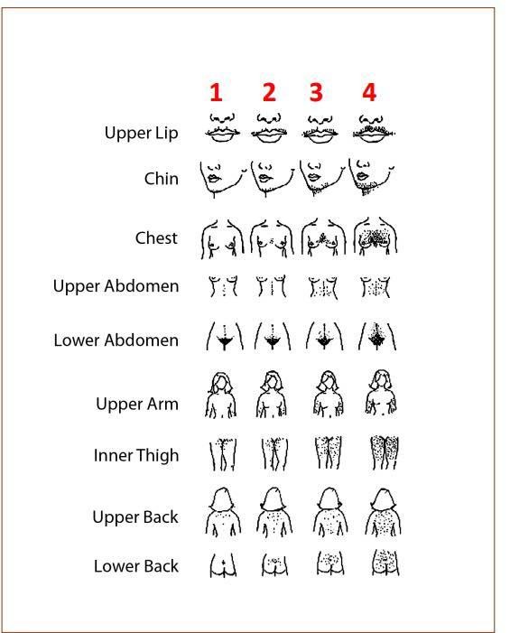 Laser Hair Reduction at Amaran