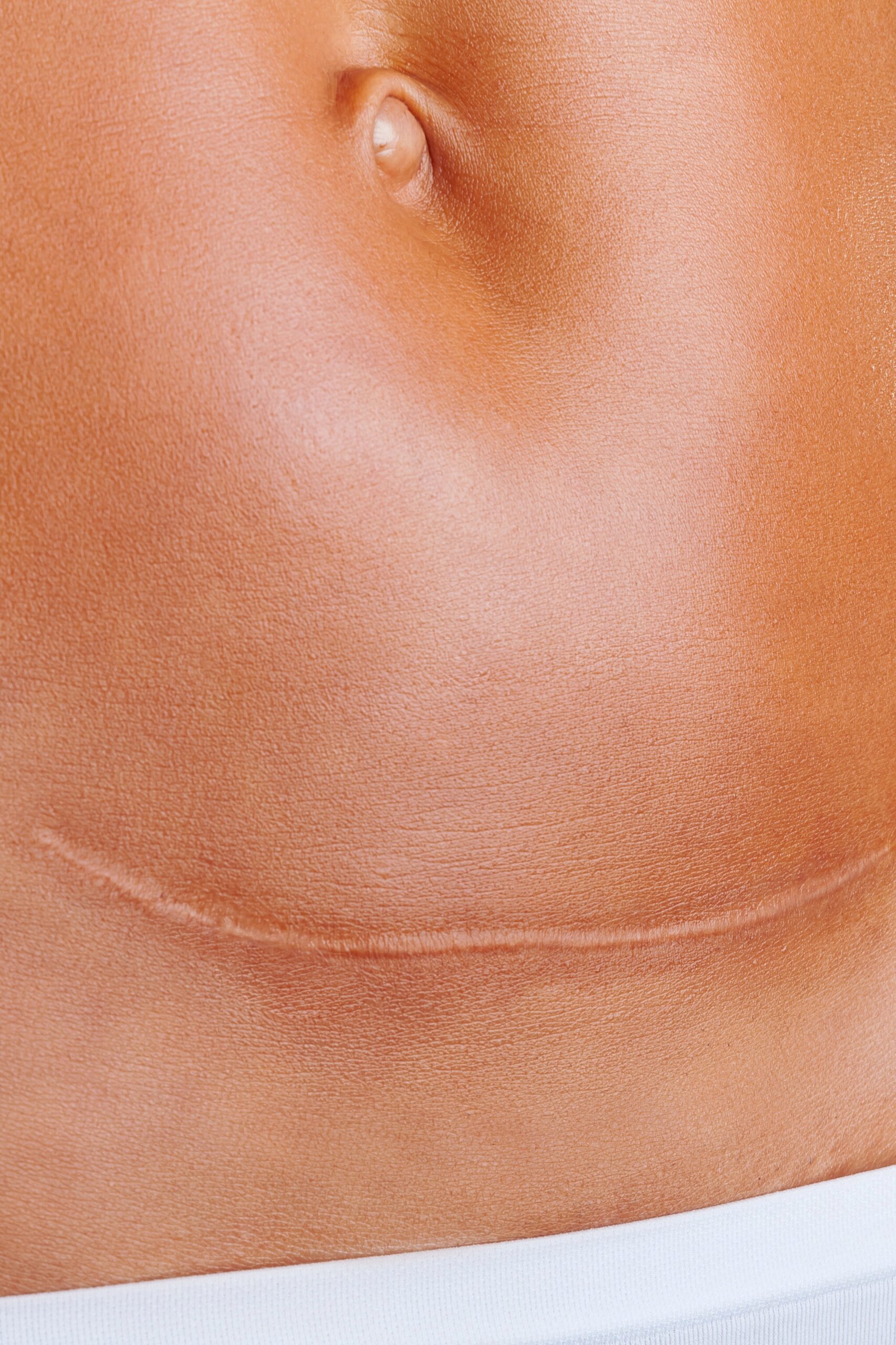 Scar Reduction Package