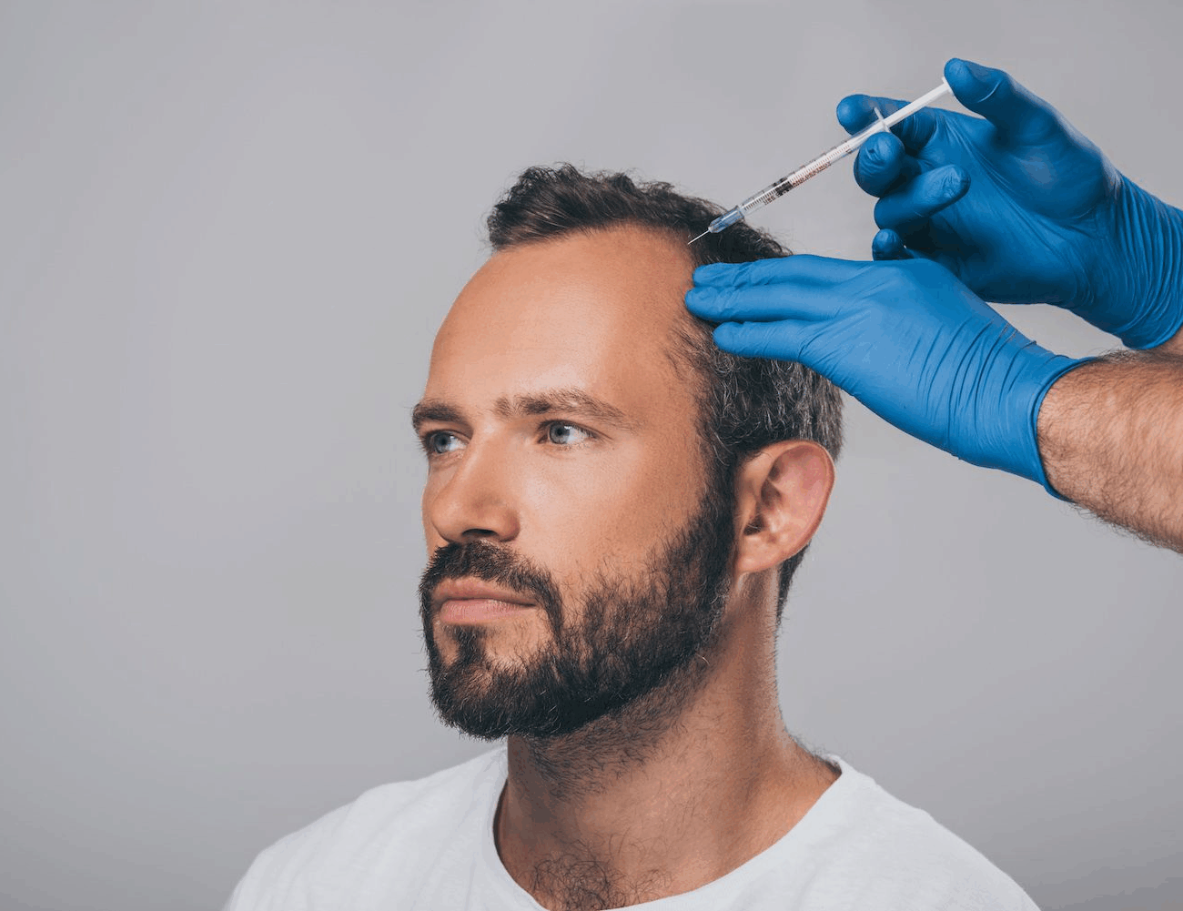 prp-therapy-for-hair-loss
