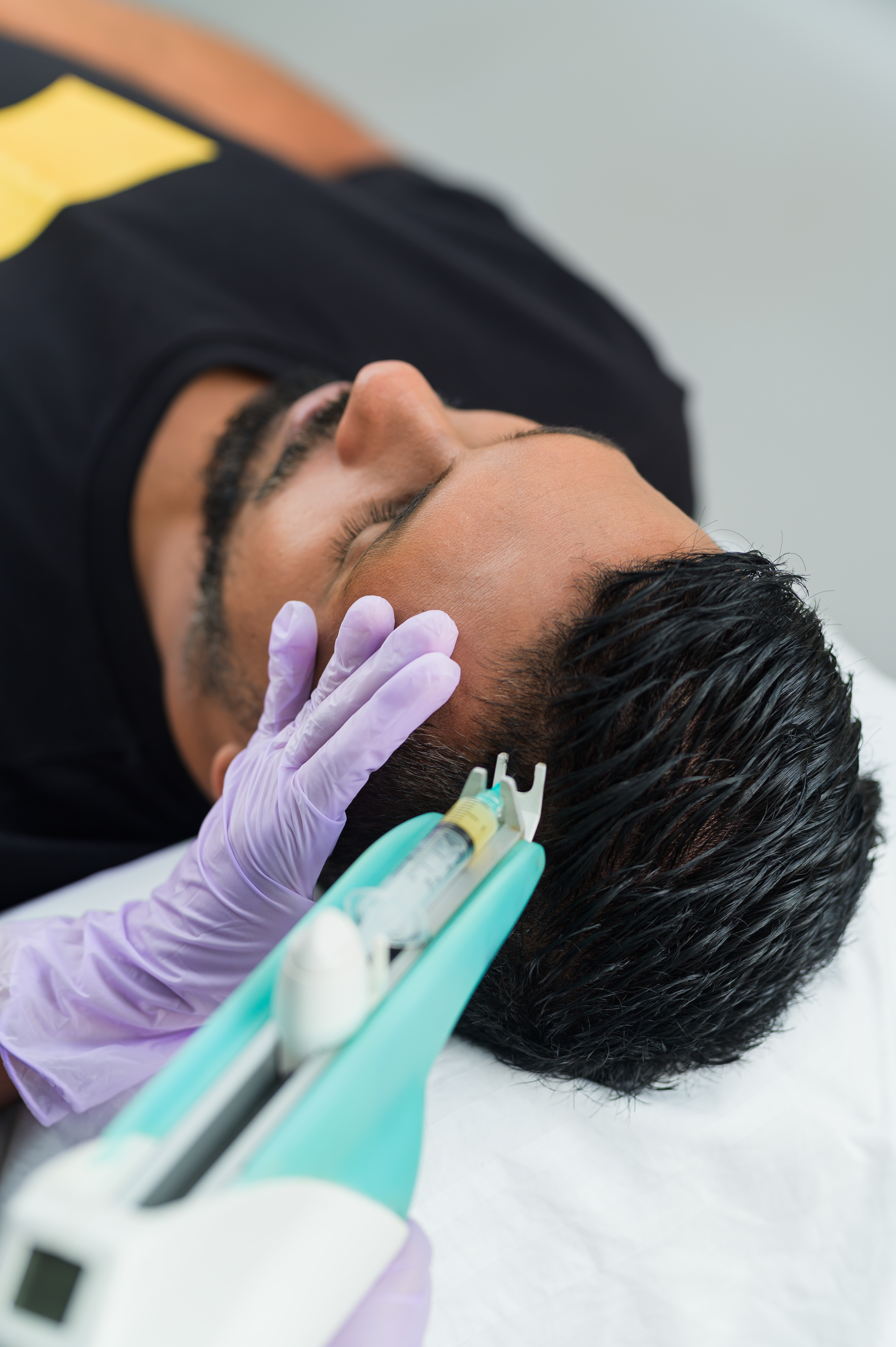 prp-therapy-for-hair-loss