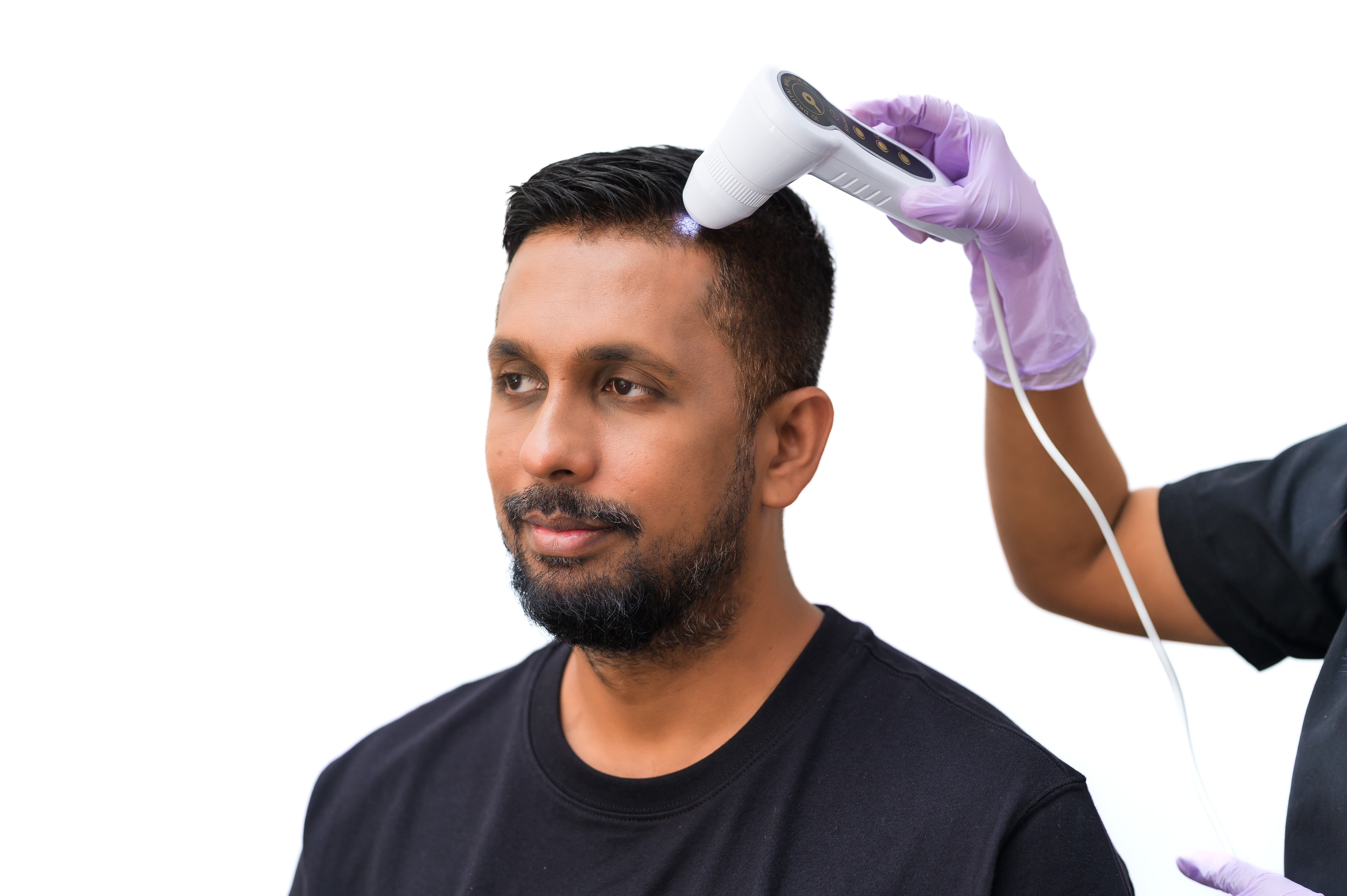 prp-therapy-for-hair-loss