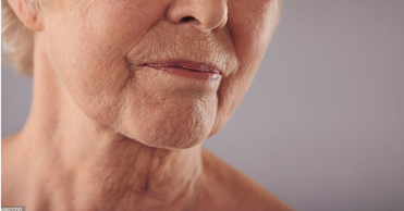 Causes of Sagging Skin